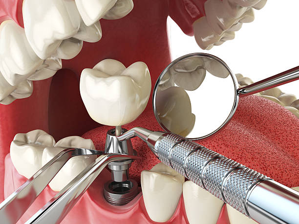 Best Emergency Treatment for Toothache in Red Oak, TX